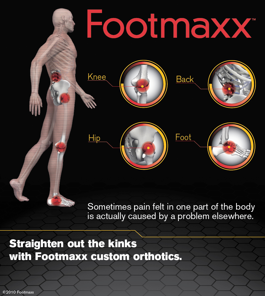 footmaxx joints